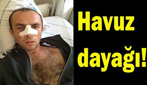 Başmüfettiş'ten otel görevlisine dayak...