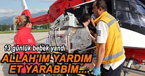 13 GÜNLÜK BEBEK YANDI