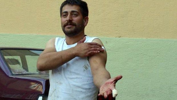 ACEMİ KASAPLAR HASTANELERİ DOLDURDU