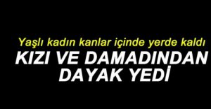 KIZI VE DAMADINDAN DAYAK YEDİ