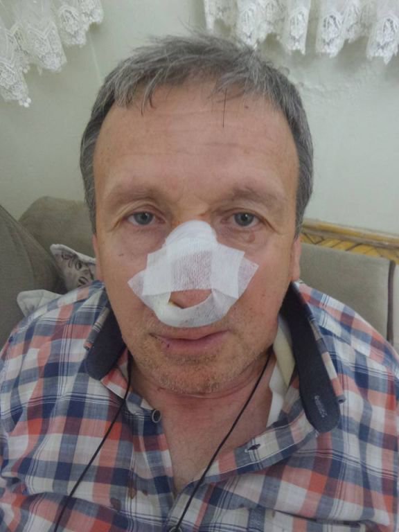 GAZETECİ HASTANELİK OLDU
