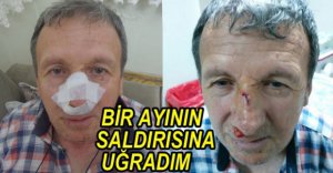 GAZETECİ HASTANELİK OLDU