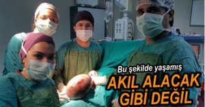 4 KİLO KİTLEYLE YAŞAMIŞ