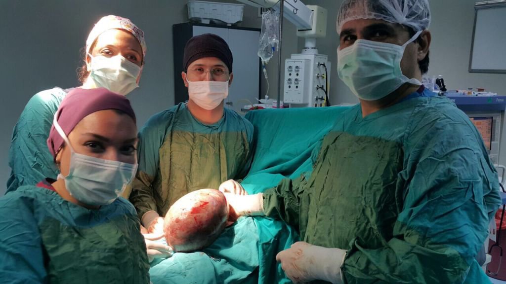 4 KİLO KİTLEYLE YAŞAMIŞ