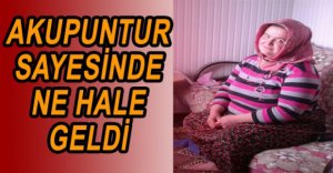 AKUPUNTUR SAYESİNDE 36 KİLO VERDİ