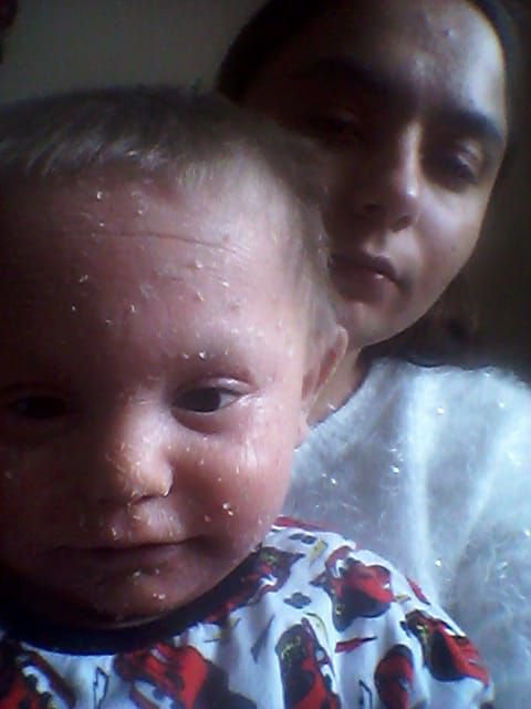 MİNİK EGE YARDIM BEKLİYOR