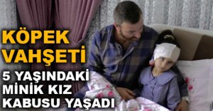 5 YAŞINDAKİ MİNİK KIZ KABUSU YAŞADI..