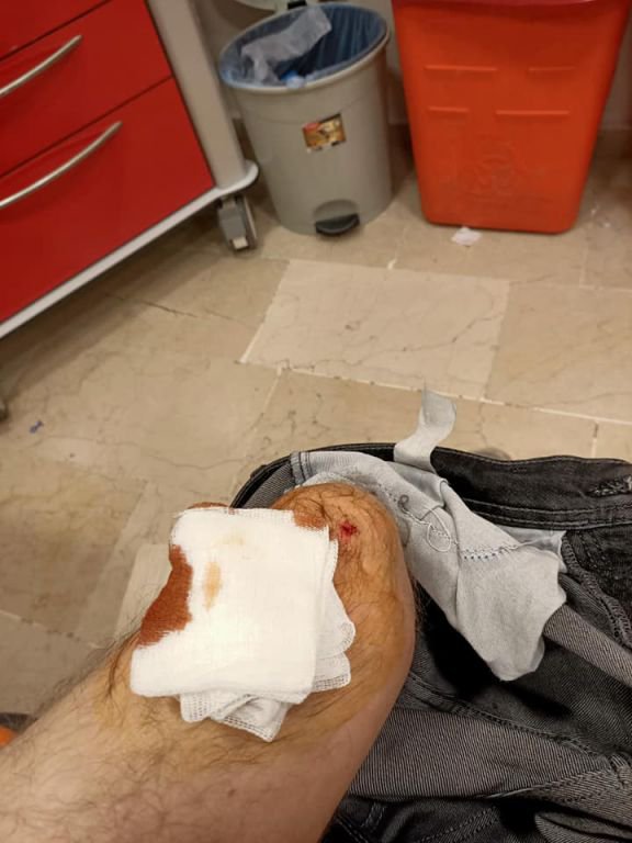 İŞE GİDERKEN DEHŞETİ YAŞADI