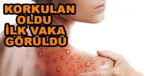 KORKULAN OLDU TÜRKİYE’YE SIÇRADI