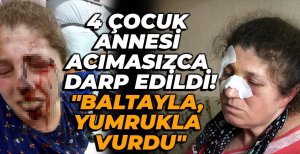 BOLU’DA 4 ÇOCUK ANNESİ ACIMASIZCA DARP EDİLDİ...