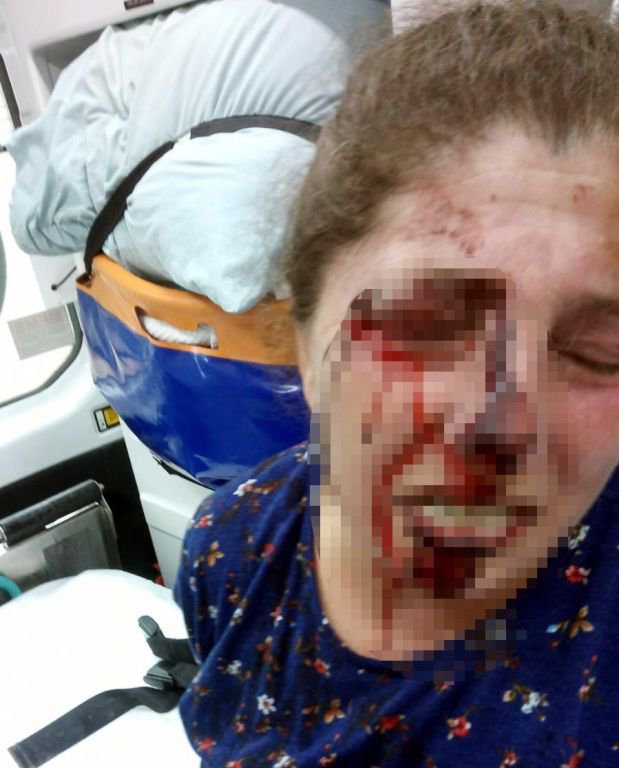 BOLU’DA 4 ÇOCUK ANNESİ ACIMASIZCA DARP EDİLDİ...