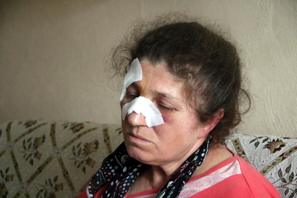 BOLU’DA 4 ÇOCUK ANNESİ ACIMASIZCA DARP EDİLDİ...