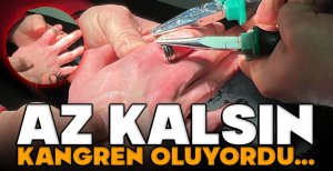 BOLU'DA İTFAİYENİN MÜDAHALESİ KANGREN OLMAKTAN KURTARDI