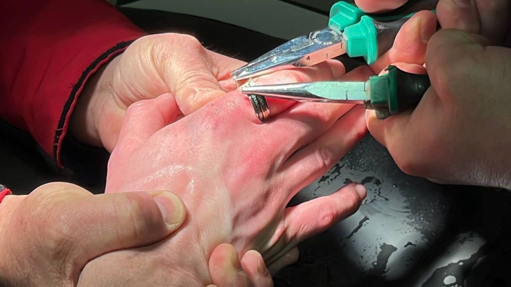 BOLU'DA İTFAİYENİN MÜDAHALESİ KANGREN OLMAKTAN KURTARDI