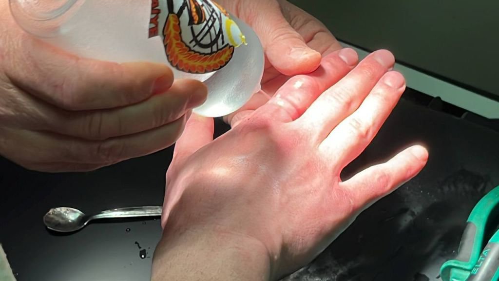 BOLU'DA İTFAİYENİN MÜDAHALESİ KANGREN OLMAKTAN KURTARDI