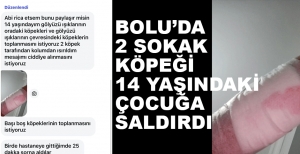 14 YAŞINDAKİ ÇOCUK 2 KÖPEĞİN SALDIRISINA UĞRADI