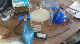 UZUN ÇABALAR SONUCUNDA BAŞARDI