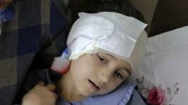 5 YAŞINDAKİ MİNİK KIZ KABUSU YAŞADI..