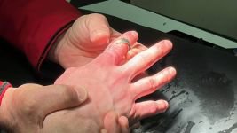 BOLU'DA İTFAİYENİN MÜDAHALESİ KANGREN OLMAKTAN KURTARDI