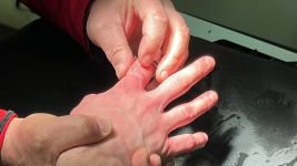 BOLU'DA İTFAİYENİN MÜDAHALESİ KANGREN OLMAKTAN KURTARDI